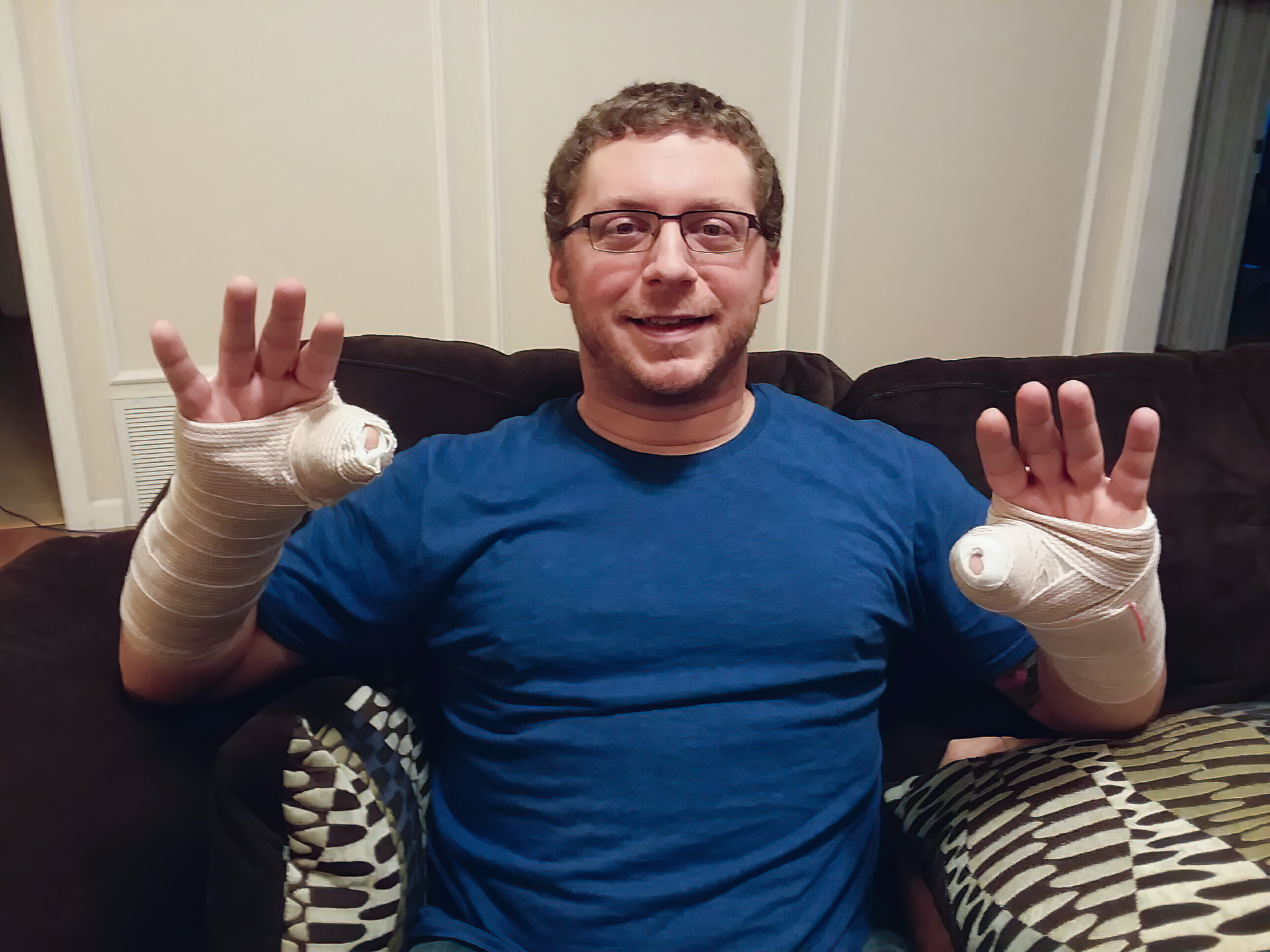 Jake LeGrand with thumbs in splints.
